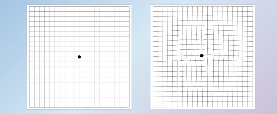 Yapay zeka ve makine öğrenimi alanında kullanılan iki farklı grafik. Sol grafik, temel bir yapay zeka algoritmasını temsil ederken, sağ grafik gelişmiş bir makine öğrenimi modelini gösteriyor. Bu görs.